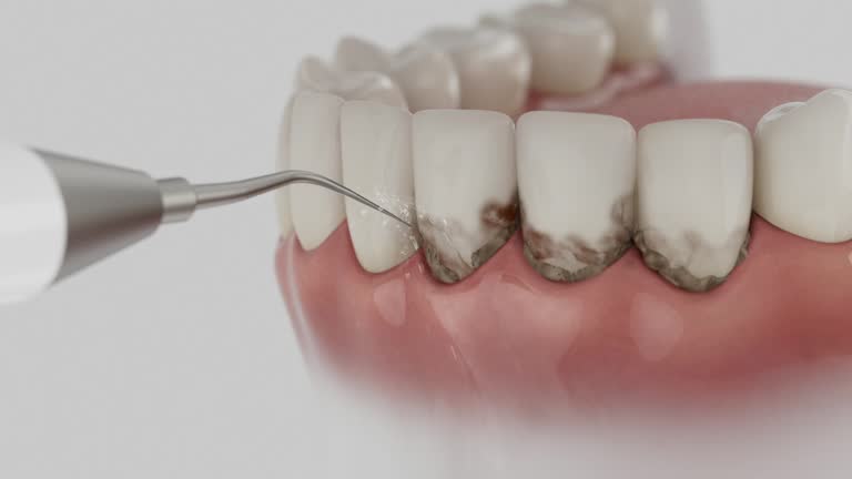 Reliable Teeth Whitening contractor in North Dakota, ND by Dentist Open Now